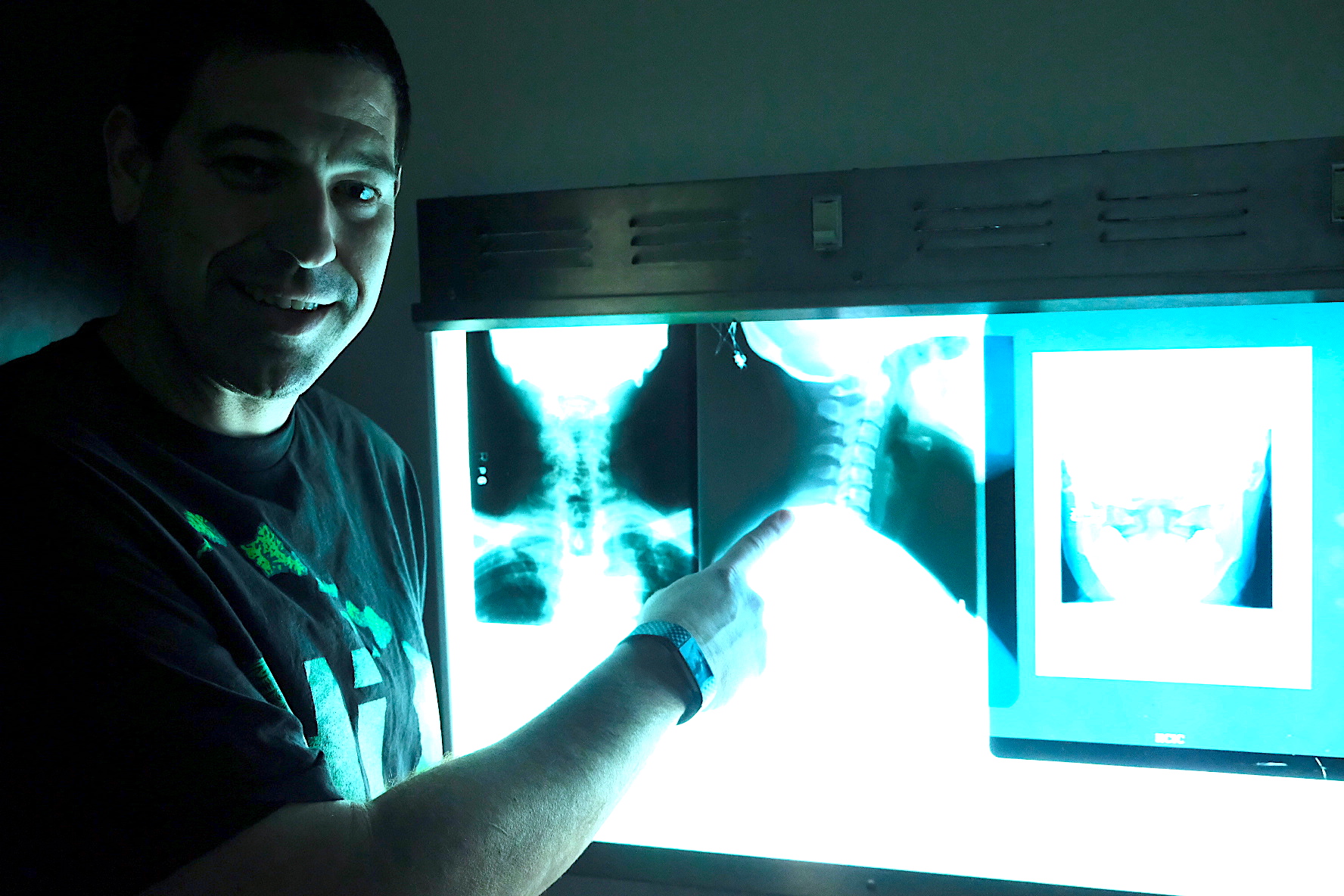 Adam Cooper previews a series of whiplash x-ray images at our Orange County Radiography School