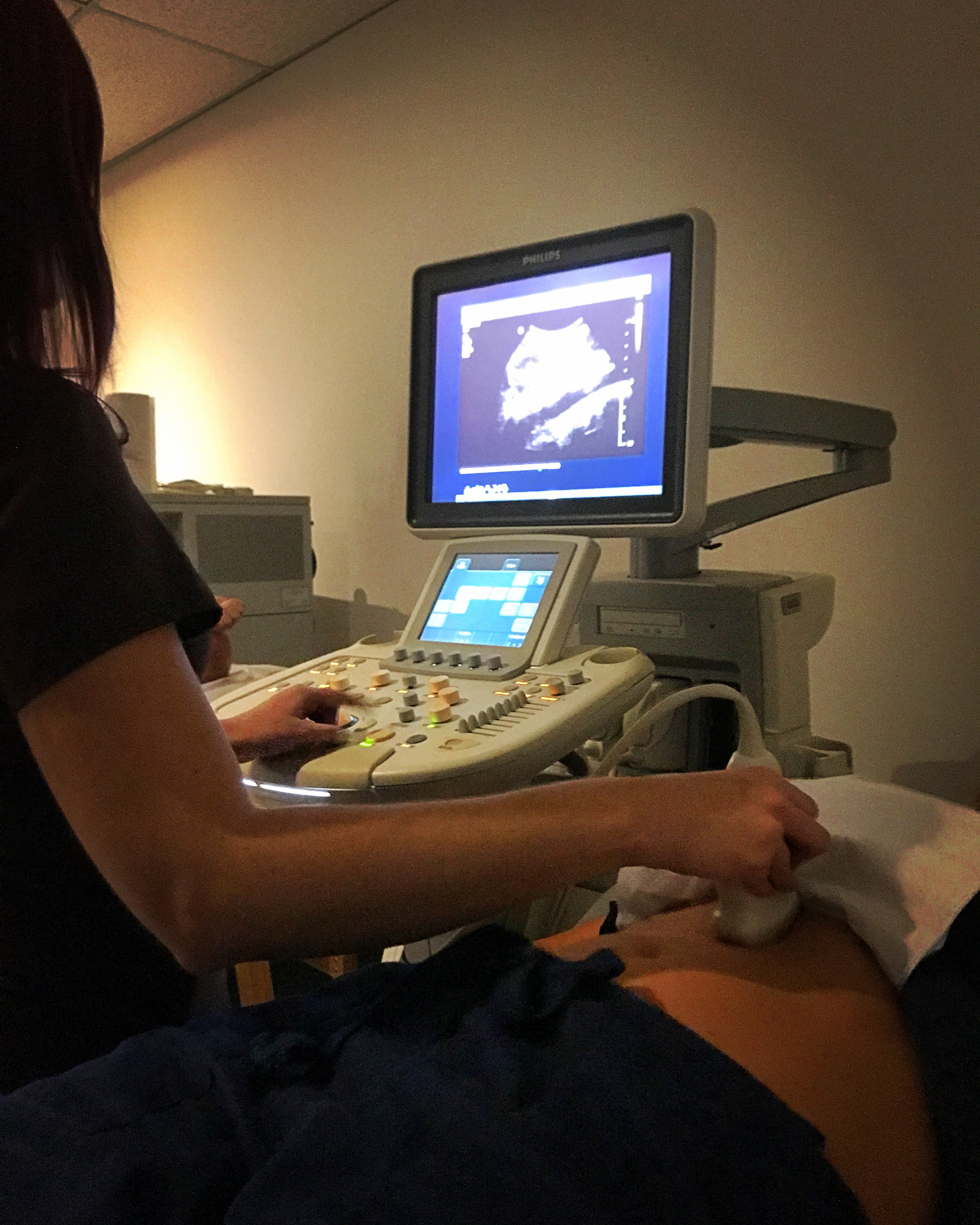 how to become an ultrasound tech